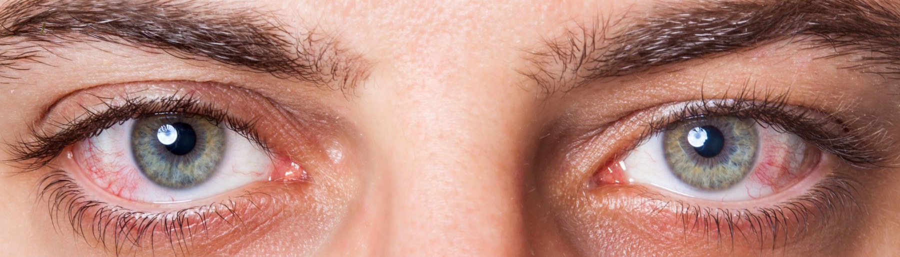 Comprendre la tension oculaire
